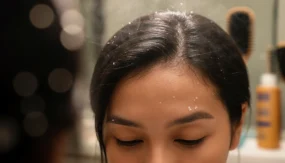 Dandruff Prevention Tips: Simple Habits That Keep Flakes Away