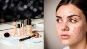 Makeup for Acne-Prone Skin: Tips for a Clearer, Safer Finish